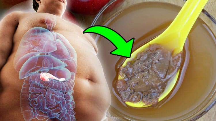 How To Use Apple Cider Vinegar For Weight Loss And Reduce Belly Fat