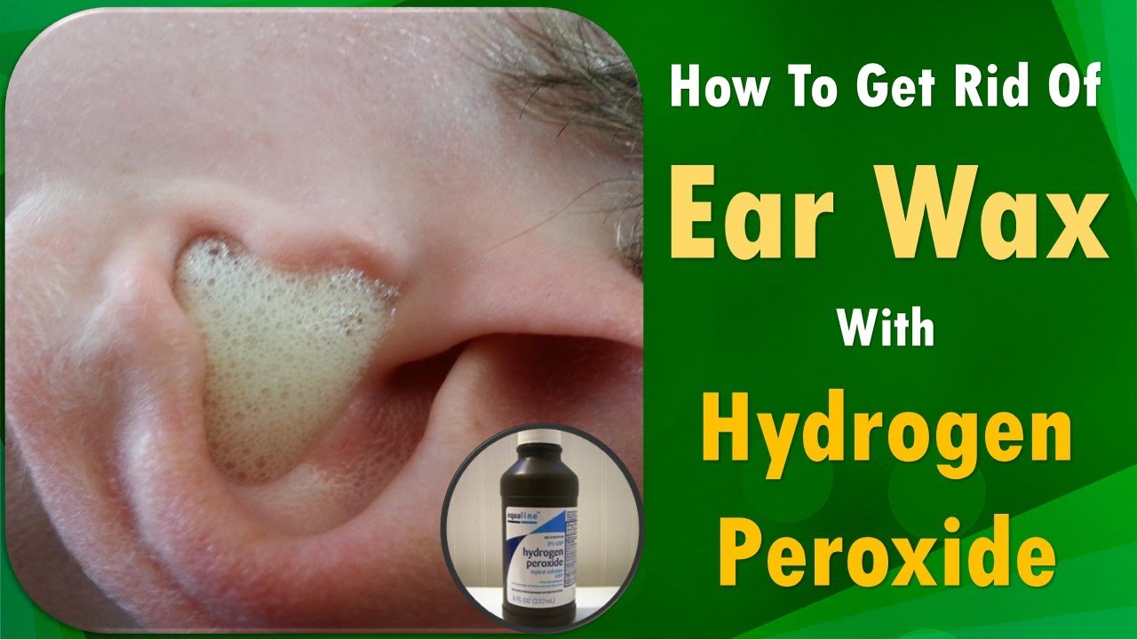 cleaning ears with hydrogen peroxide