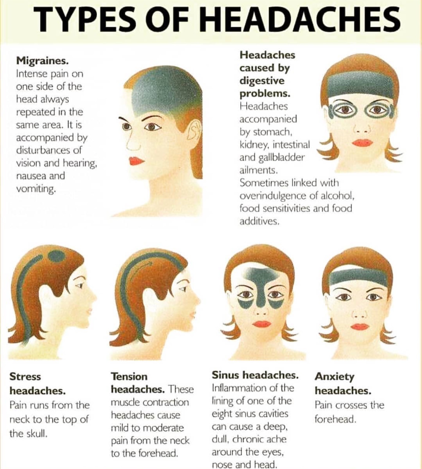 6 Different Types Of Headaches That You Should Know About