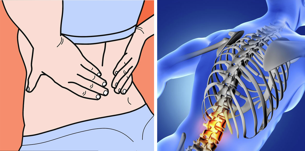 Common Vitamin Deficiency That Is Causing Your Agonizing Back And Joint 