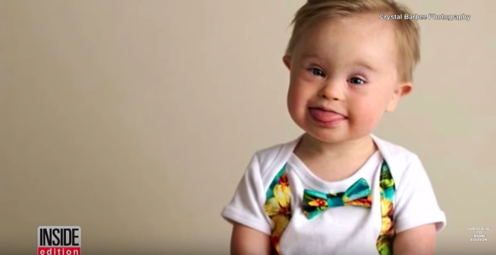 Adorable Boy With Down Syndrome Finally Becomes A Model After Getting ...